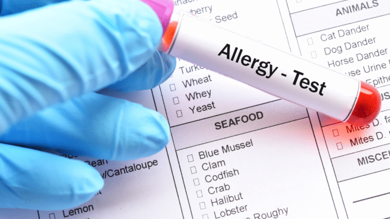 allergy awareness